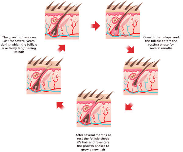 Info_3-1
